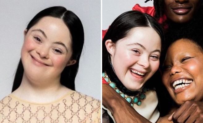 Gucci Beauty choisit une mannequin atteinte de trisomie 21 comme égérie