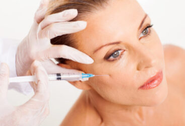 Botox : tout ce que vous devez savoir sur les injections de Toxine Botulique.