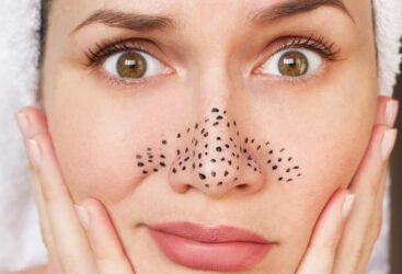 Le secret pour dire adieu aux points noirs sans nuire à votre peau.
