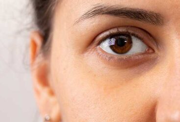 Révélez l&rsquo;éclat de votre regard avec des astuces naturelles contre les cernes.