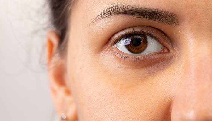 Révélez l&rsquo;éclat de votre regard avec des astuces naturelles contre les cernes.