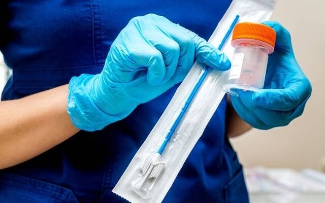 Tout sur le frottis cervico-vaginal : Un geste essentiel pour la santé féminine.