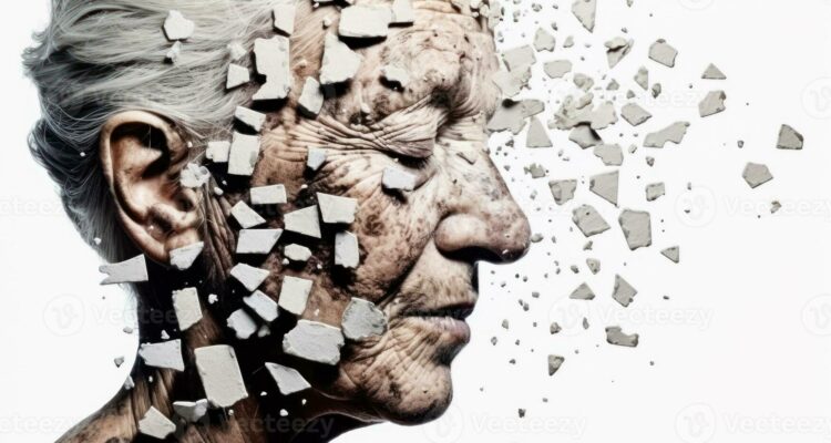 Découvrez les Raisons Sous-jacentes à la Prédominance de la Maladie d&rsquo;Alzheimer chez les Femmes: Révélations d&rsquo;une Nouvelle Étude.