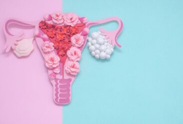 Le Syndrome des Ovaires Polykystiques : Un Défi Pour de Nombreuses Femmes.