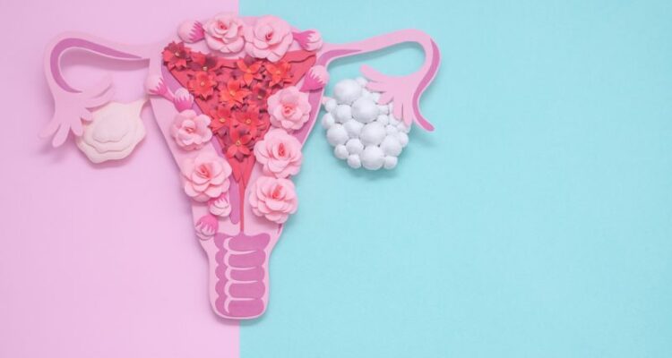 Le Syndrome des Ovaires Polykystiques : Un Défi Pour de Nombreuses Femmes.