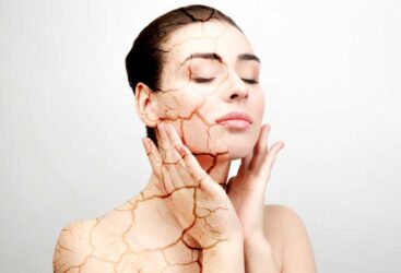 LES LÉGUMES ESSENTIELS POUR LUTTER CONTRE LA PEAU SÈCHE